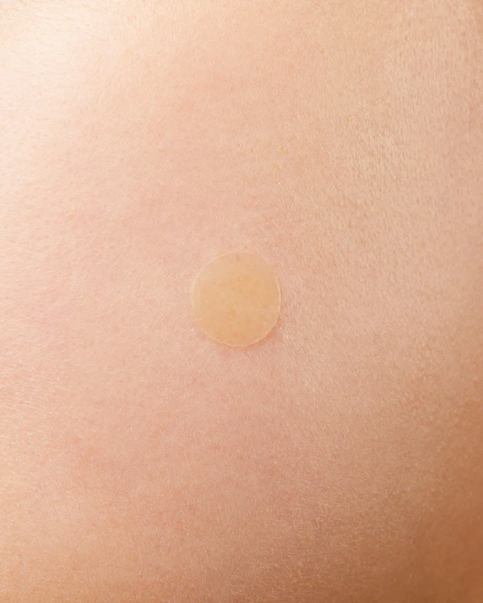 Acne Pimple Master Patch - Image 5