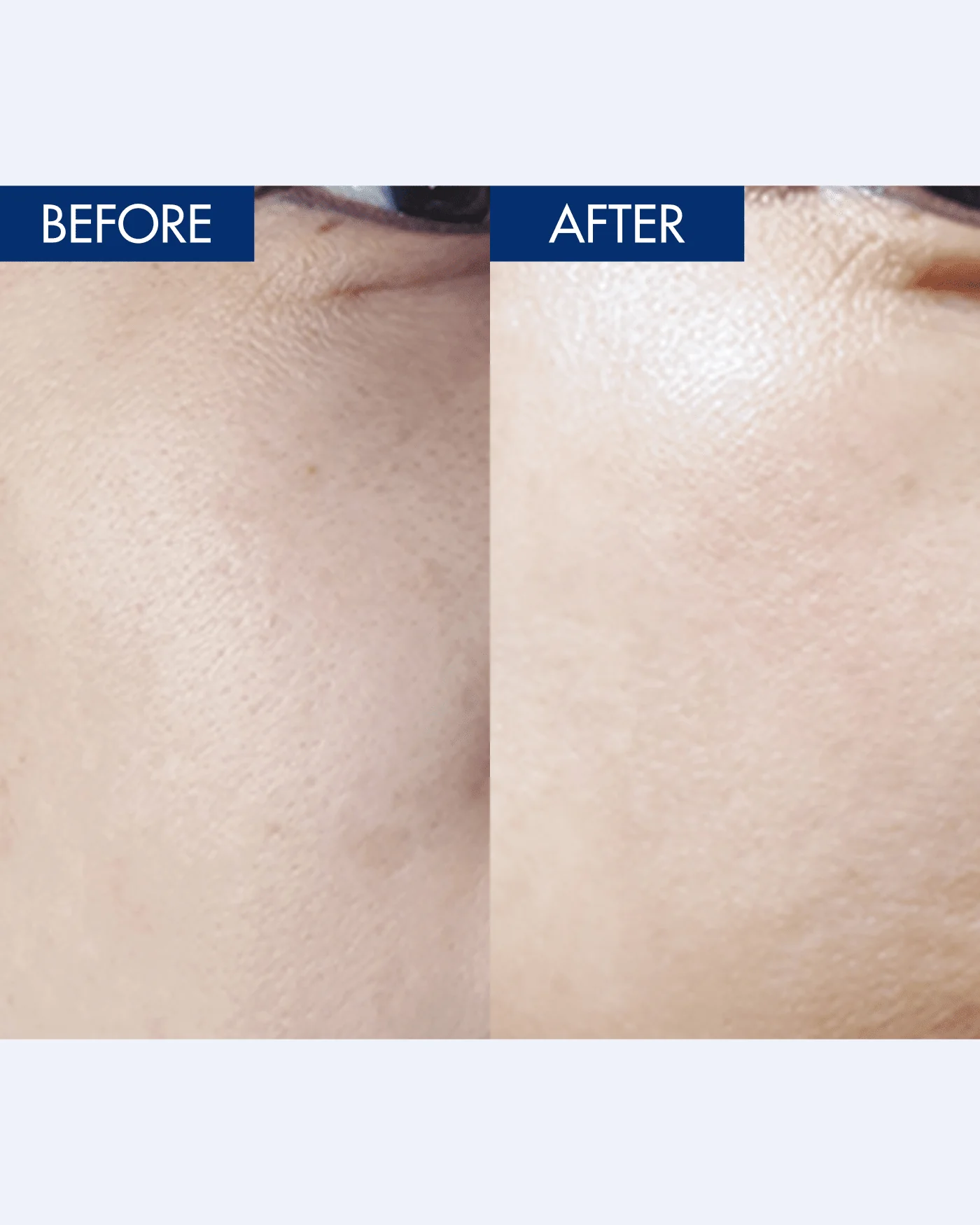 YULMU  Brightening Spot Cream - Image 3