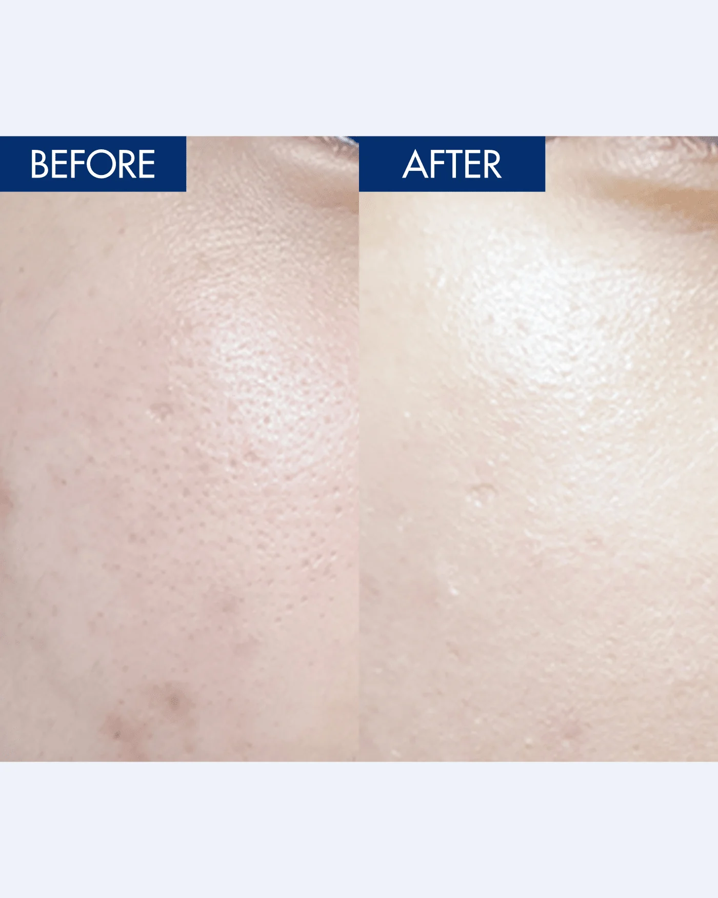 YULMU  Brightening Spot Cream - Image 4