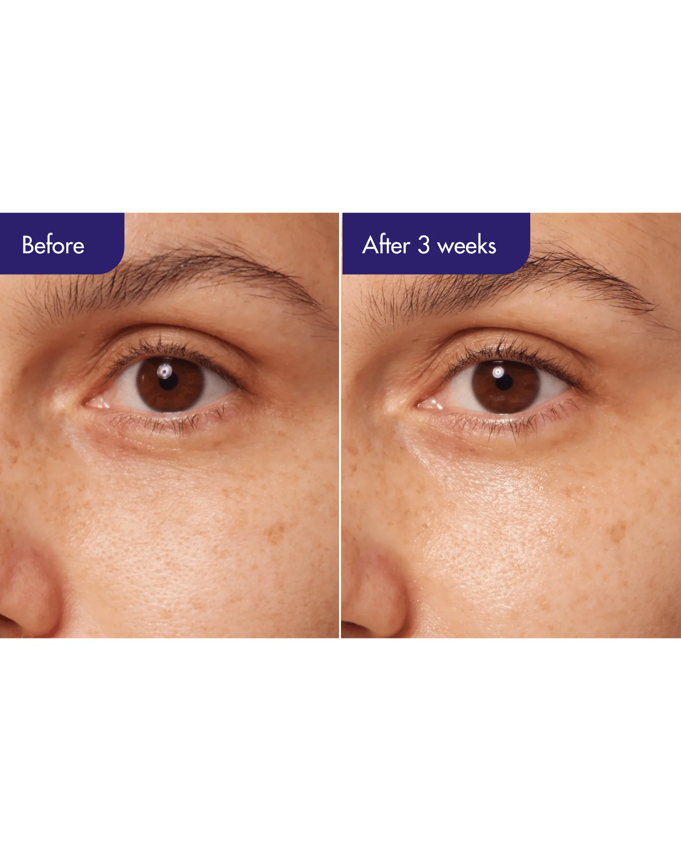 Retinol Expert 0.1% - Image 4