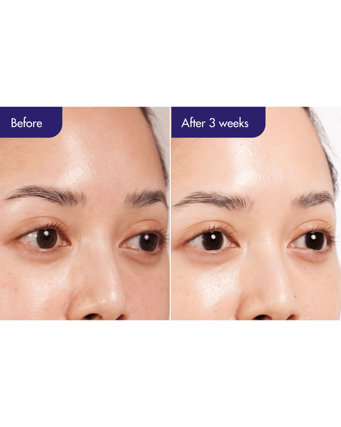 Expert Retinol Super Bounce Serum - Image 5