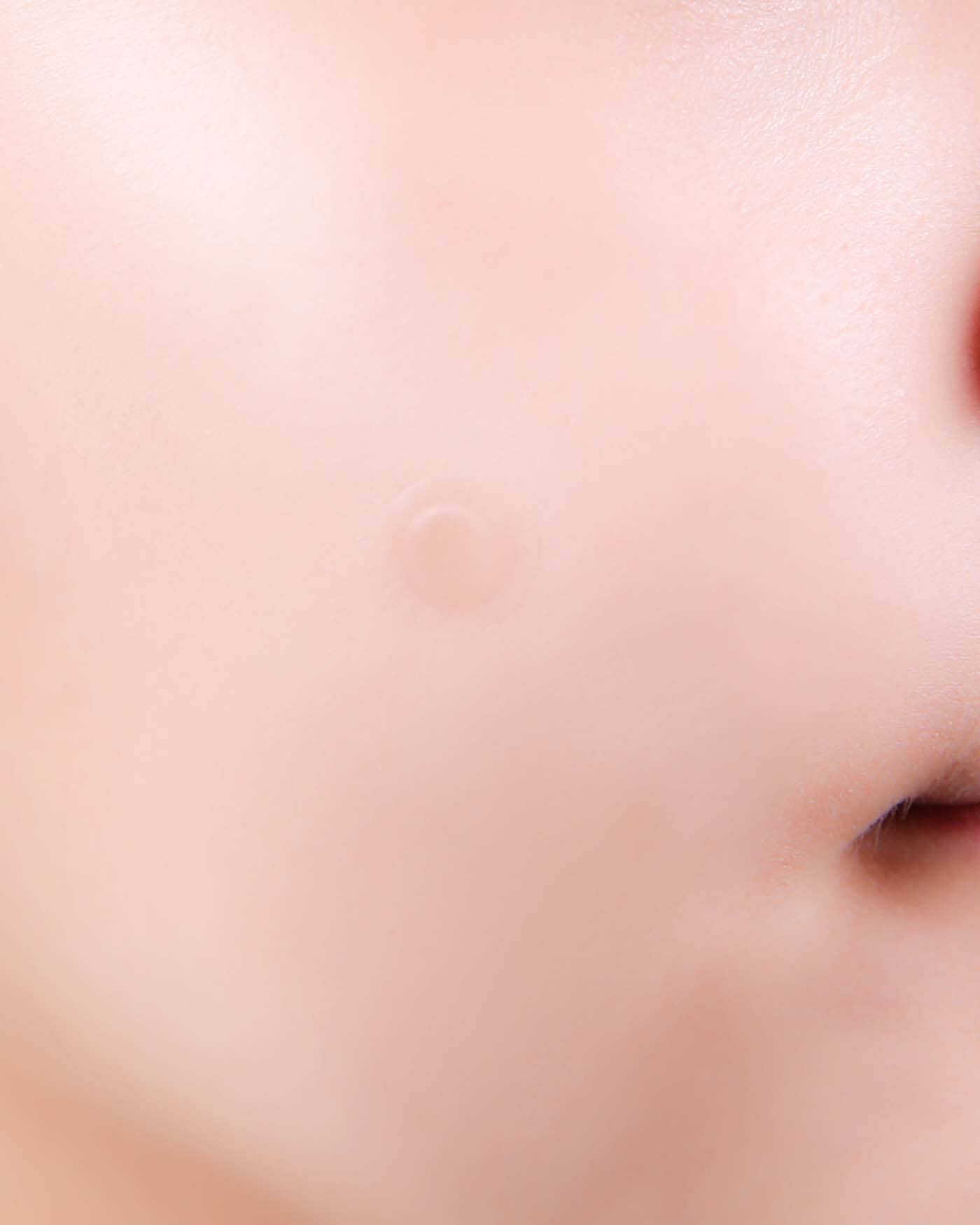A-Clear Soothing Clear Spot Patch - Image 3