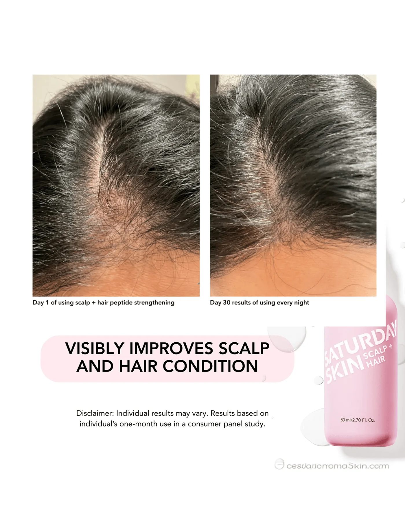 Scalp + Hair Strengthening Peptide Treatment - Image 5