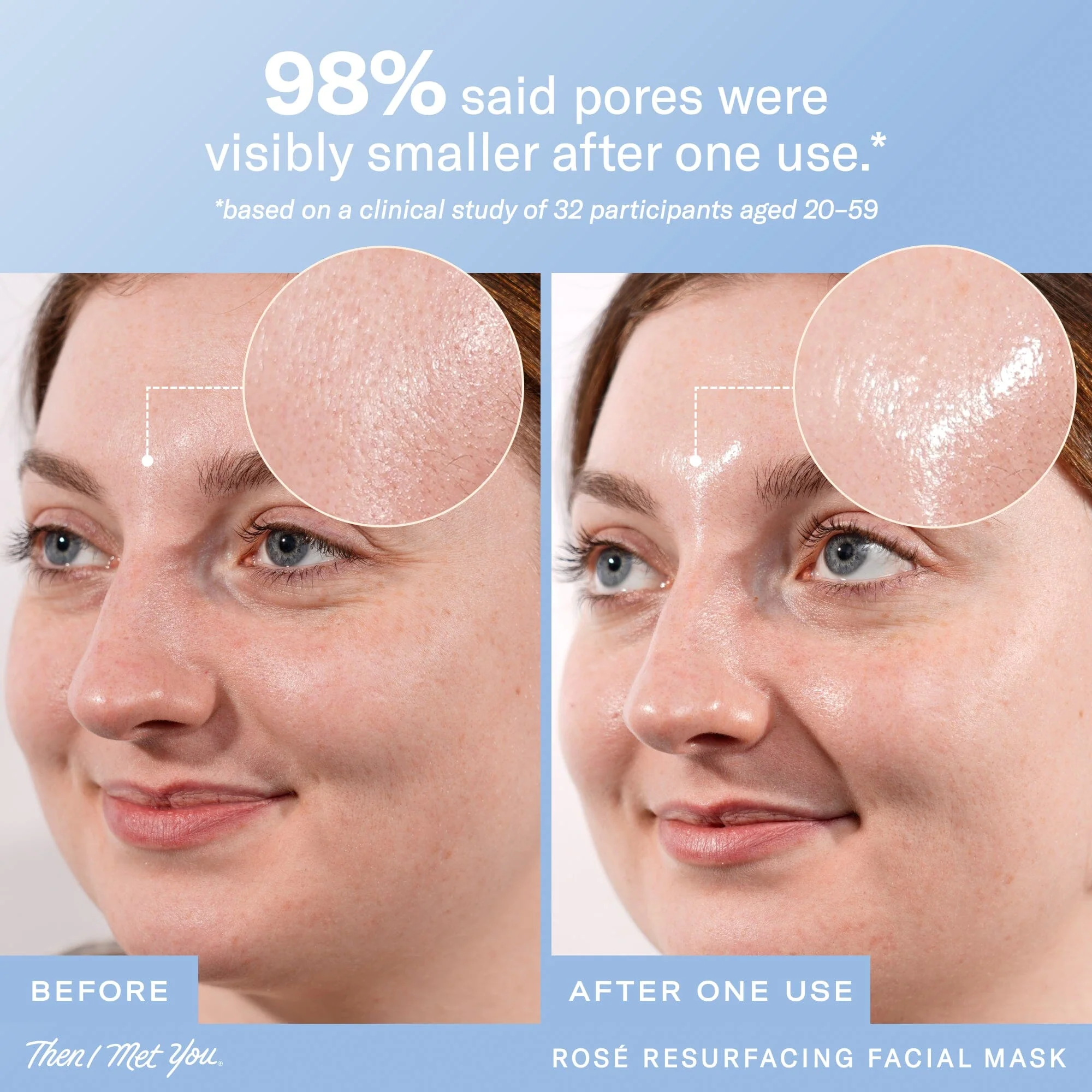 Rosé Resurfacing Facial Mask - Image 3