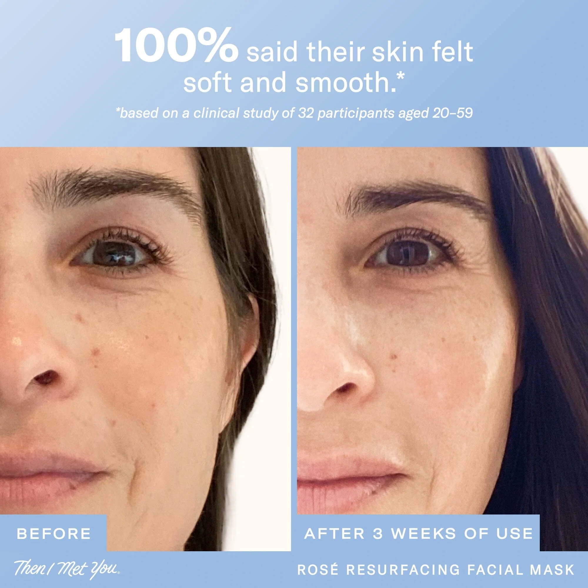 Rosé Resurfacing Facial Mask - Image 4