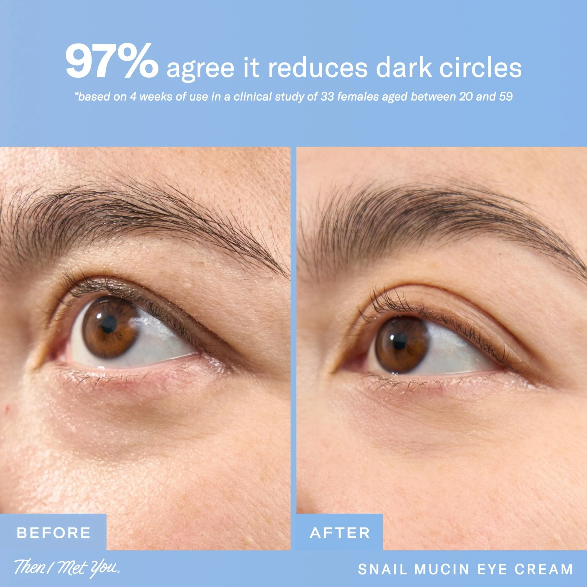 Snail Mucin Eye Cream - Image 4