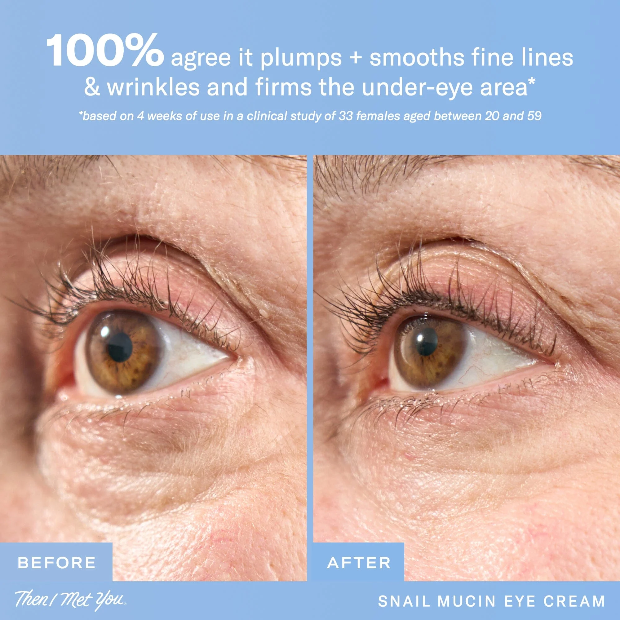 Snail Mucin Eye Cream - Image 5